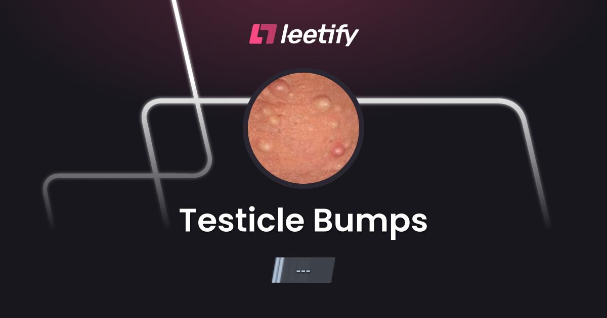 Testicle Bumps - CS2 Stats and Player Profile - Leetify